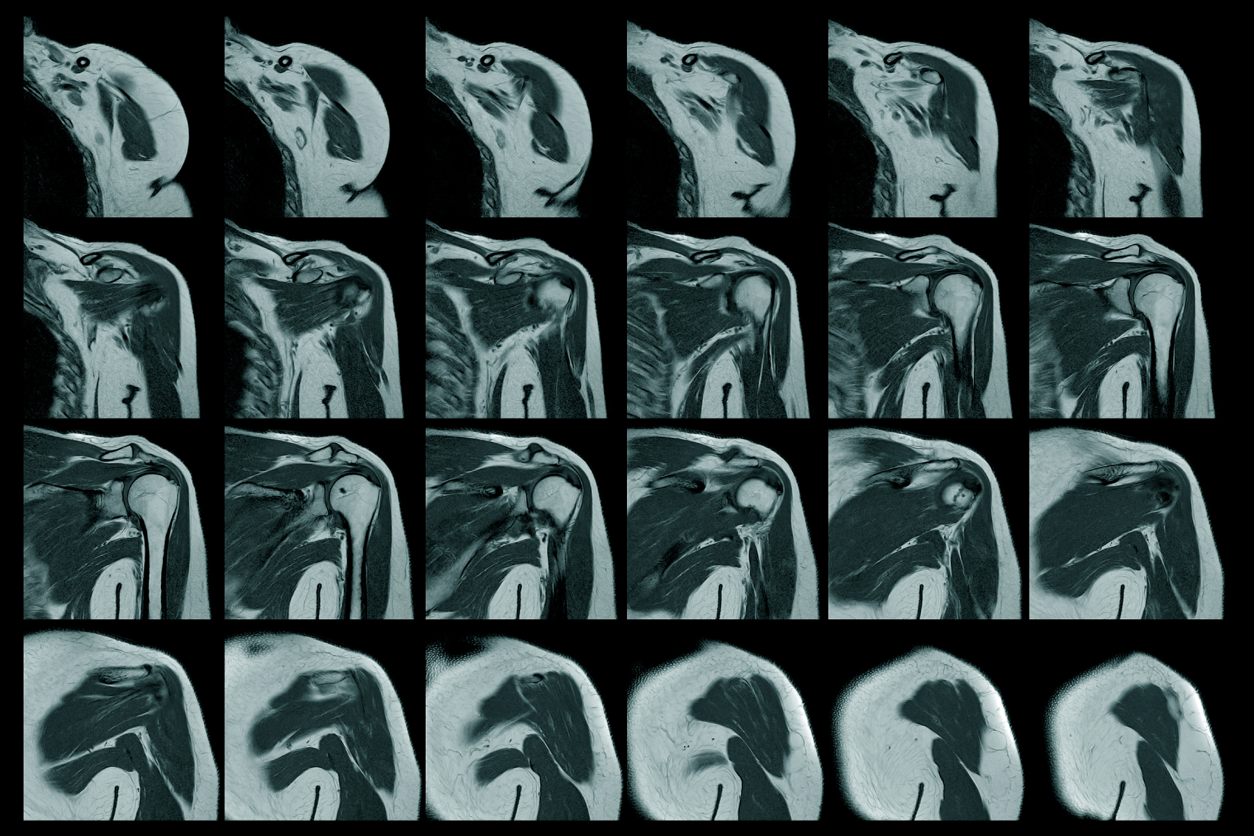 Musculoskeletal MRI at Stone Imaging, Kerrville TX